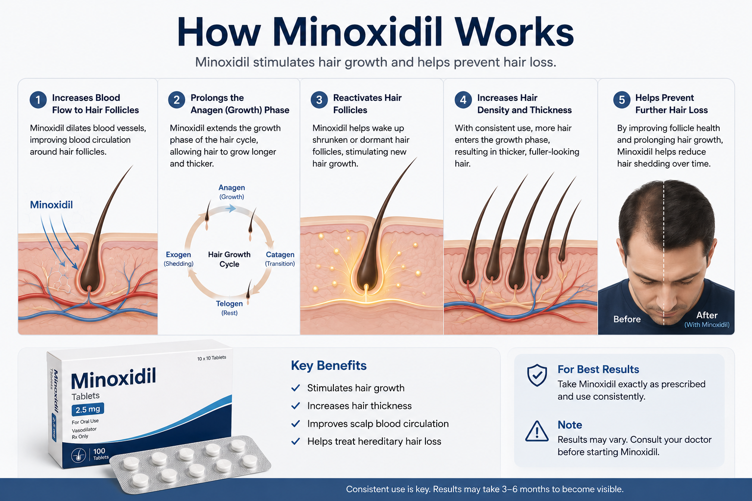 How Minoxidil Works